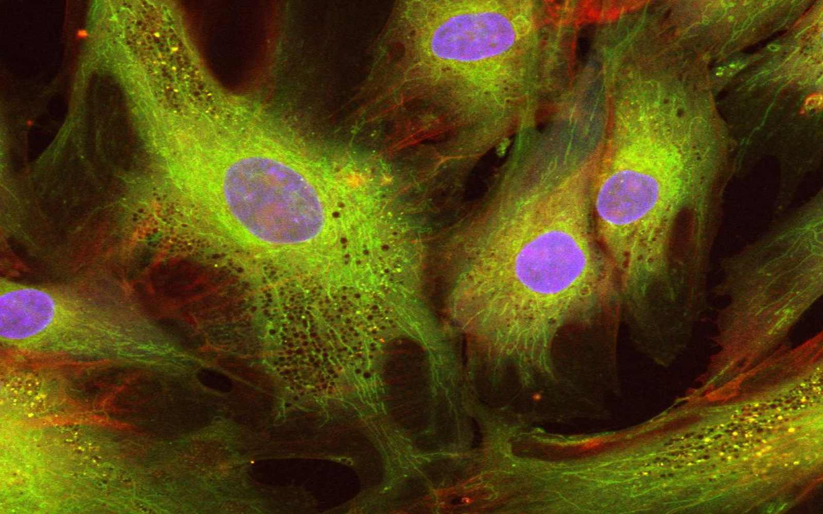 Blog-Image_1600x1000