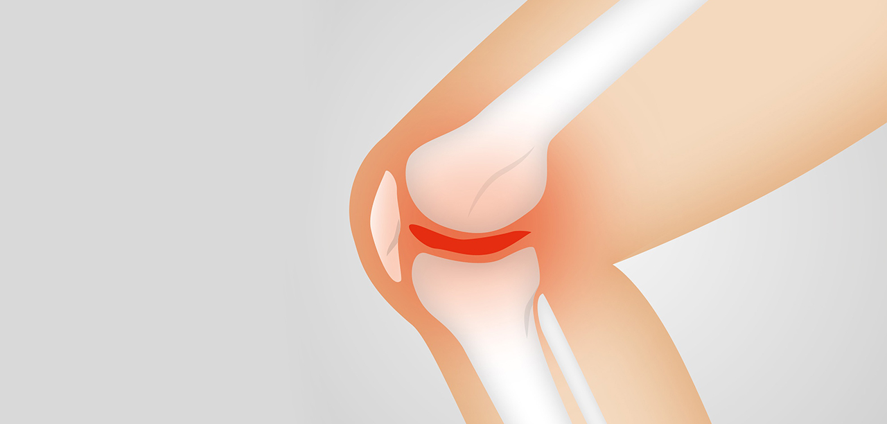 Neuromuscular Exercise